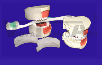 Dental Care Model of Child